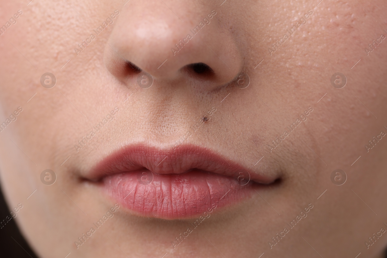Woman with mole on her face, closeup Photo of Woman with mole on her face, closeup