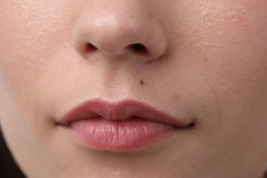 Photo of Woman with mole on her face, closeup