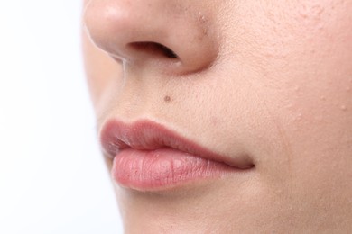 Photo of Woman with mole on her face against white background, closeup