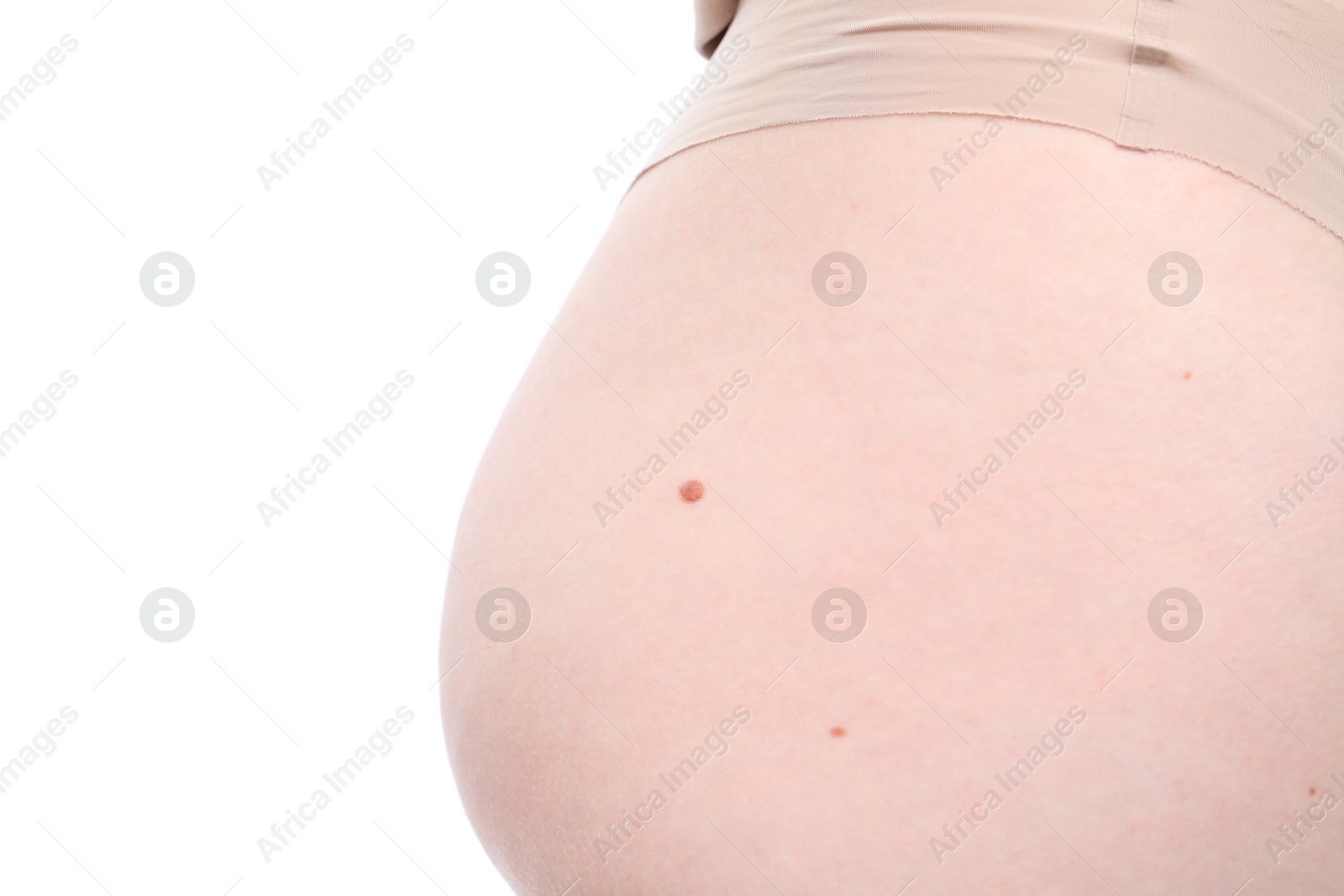 Woman with mole on her body against white background, closeup Photo of Woman with mole on her body against white background, closeup