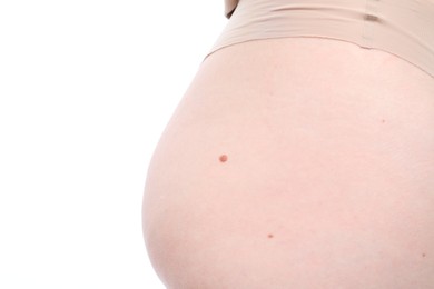 Photo of Woman with mole on her body against white background, closeup