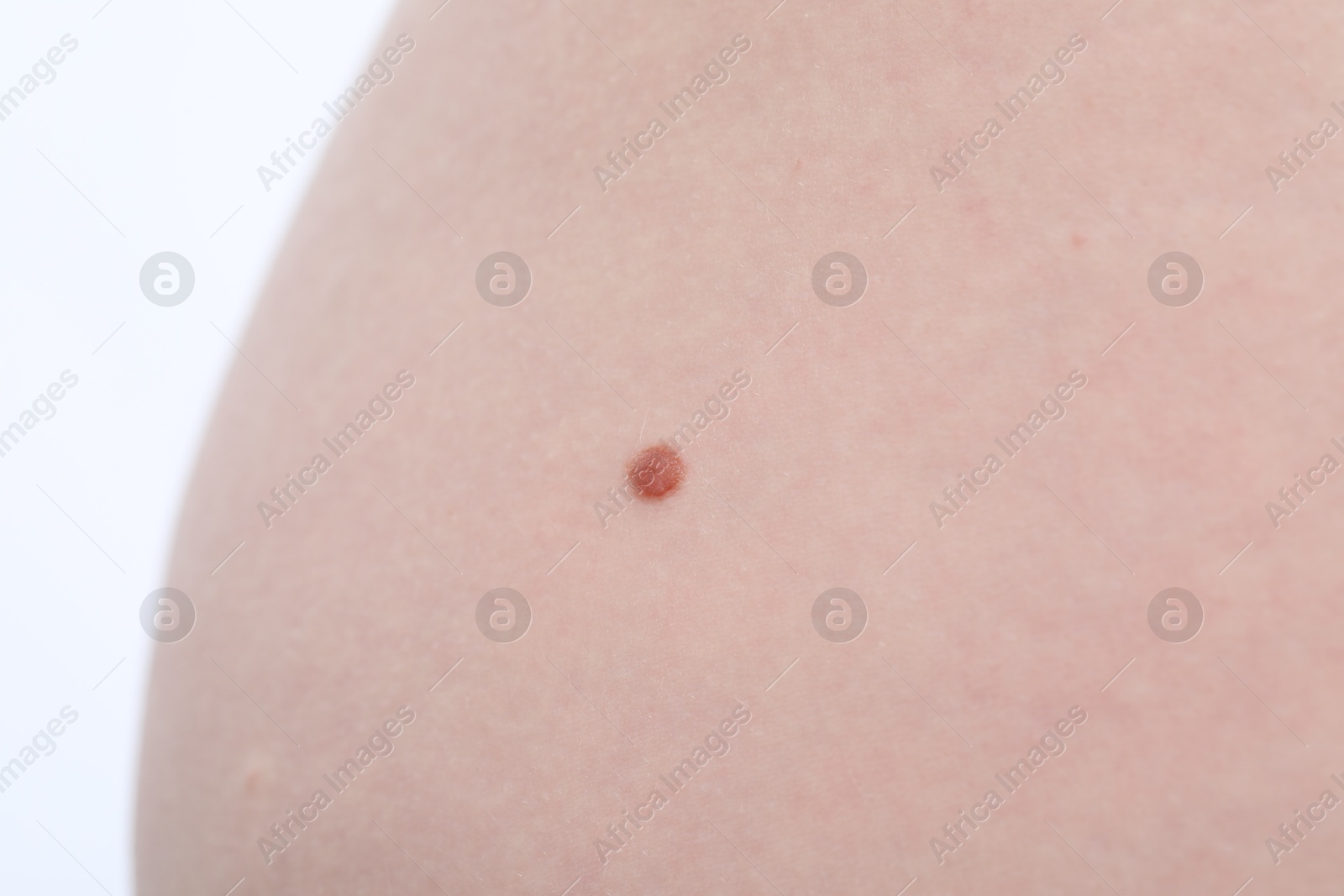 Woman with mole on her body against white background, closeup Photo of Woman with mole on her body against white background, closeup