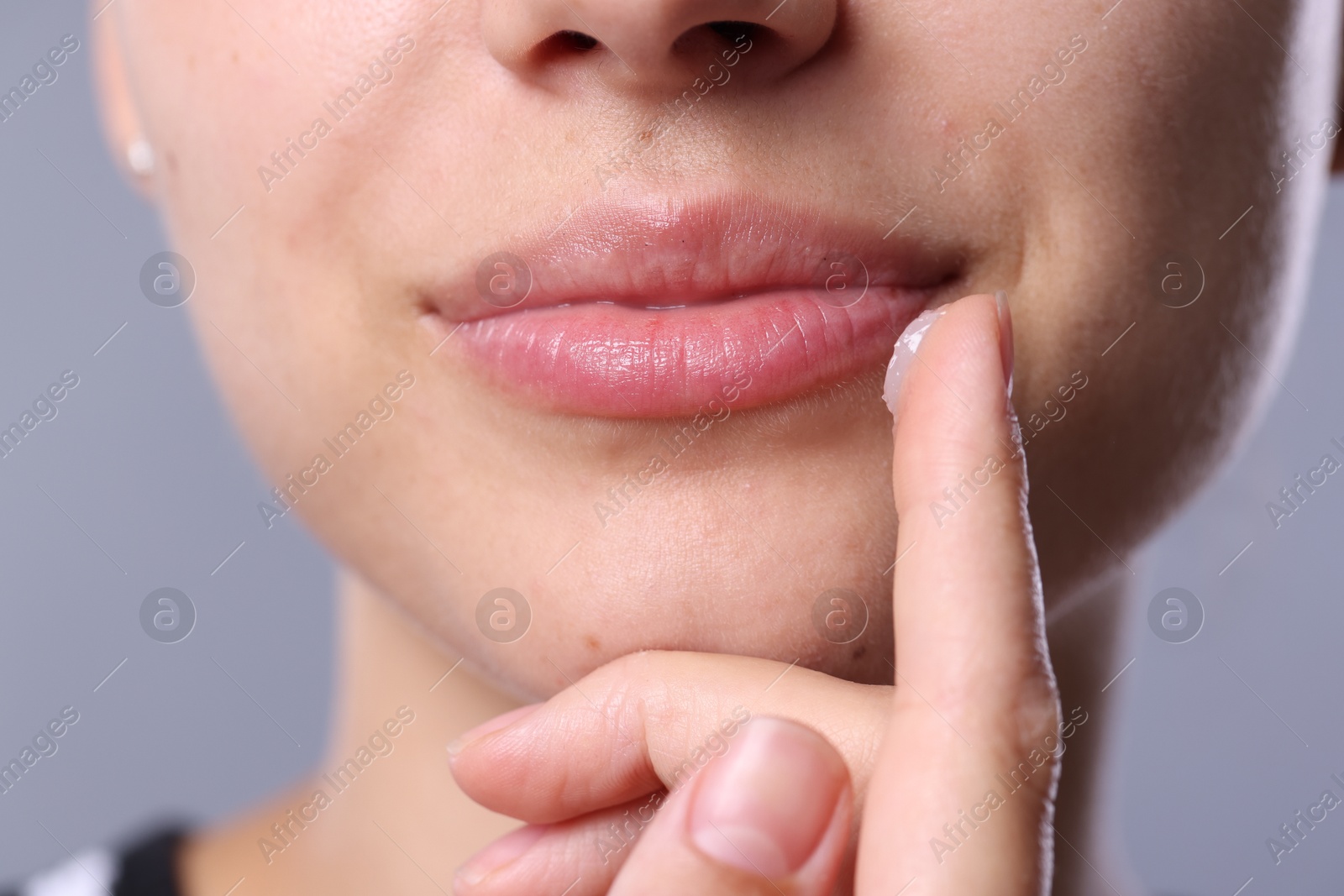 Young woman with lip balm on light grey background, closeup Photo of Young woman with lip balm on light grey background, closeup