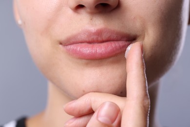 Photo of Young woman with lip balm on light grey background, closeup