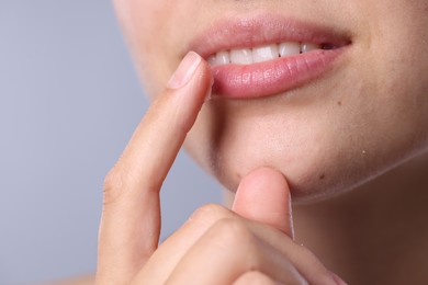 Photo of Young woman with lip balm on light grey background, closeup