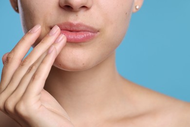 Photo of Young woman with lip balm on her lips against light blue background, closeup
