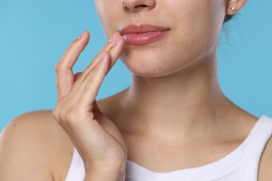 Photo of Young woman with lip balm on her lips against light blue background, closeup