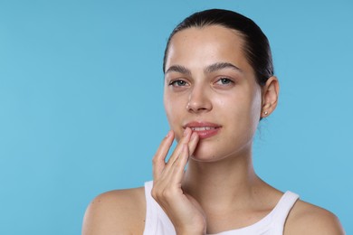 Photo of Young woman with lip balm on her lips against light blue background, space for text