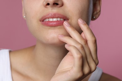 Photo of Young woman with lip balm on her lips against pink background, closeup