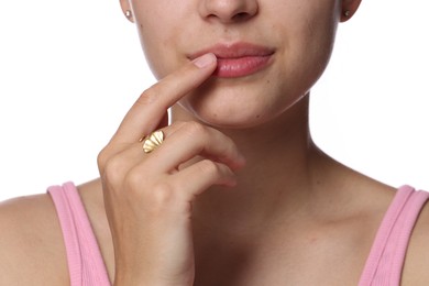 Photo of Young woman with lip balm on her lips against white background, closeup