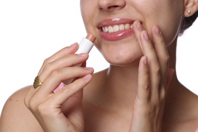 Photo of Young woman with lip balm on white background, closeup