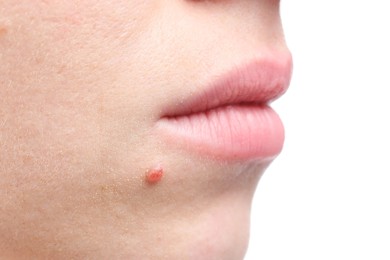 Photo of Woman with mole on her face against white background, closeup