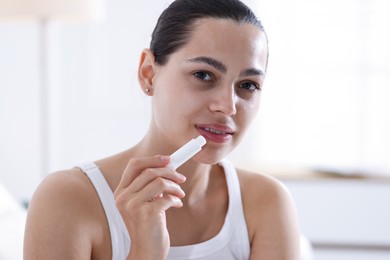 Photo of Young woman with lip balm at home