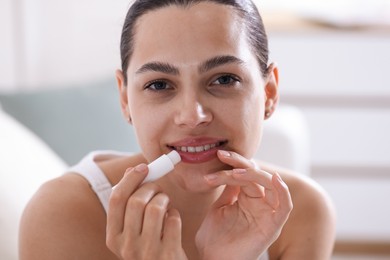 Photo of Young woman with lip balm at home