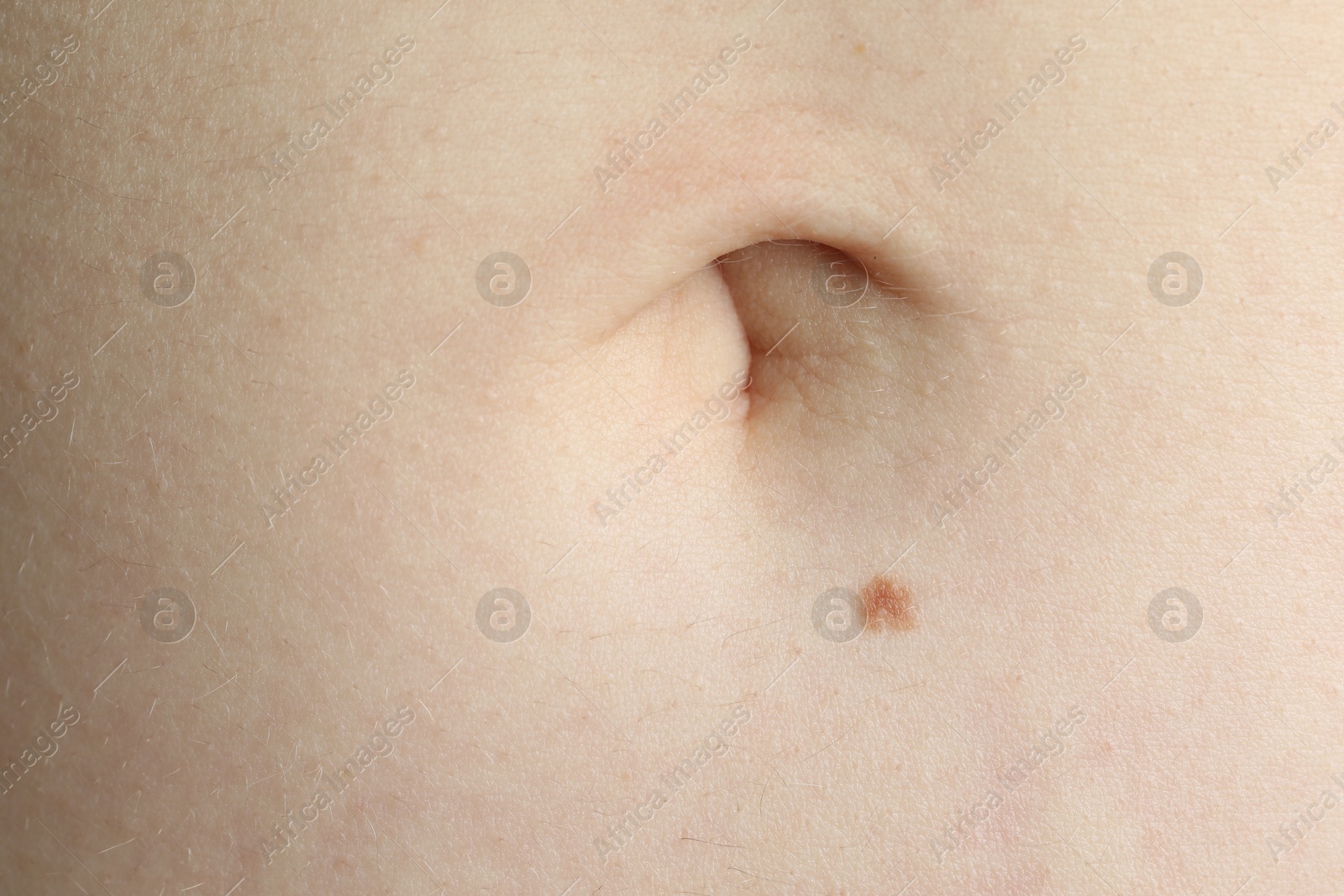 Woman with mole on her skin, macro view Photo of Woman with mole on her skin, macro view