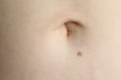 Photo of Woman with mole on her skin, macro view