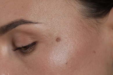 Photo of Woman with moles on her face, closeup
