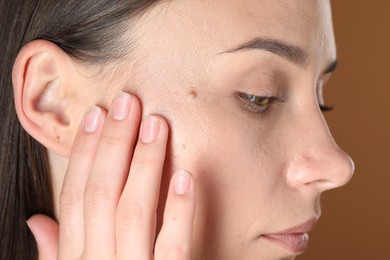 Photo of Woman with moles on her face against brown background, closeup