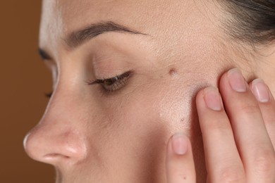 Photo of Woman with moles on her face against brown background, closeup