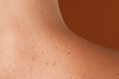 Photo of Woman with moles on her body against brown background, closeup