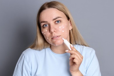Photo of Woman applying cream onto face on grey background. Acne treatment