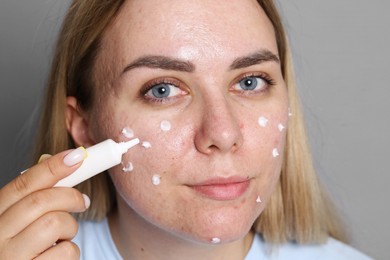 Photo of Woman applying cream onto face on grey background. Acne treatment