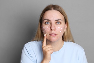 Photo of Woman applying cream onto face on grey background. Acne treatment