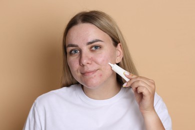 Photo of Woman applying cream onto face on beige background. Acne treatment