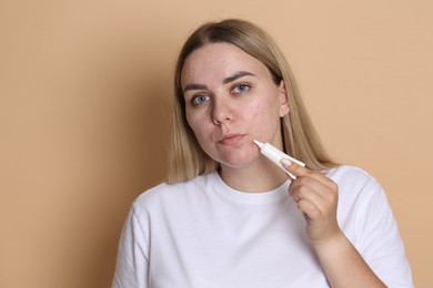 Photo of Woman applying cream onto face on beige background. Acne treatment