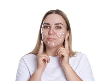 Photo of Woman applying cream onto face on white background. Acne treatment
