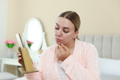 Photo of Woman with acne problem looking in mirror at home