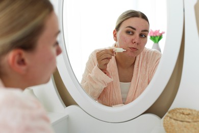 Photo of Woman applying cream onto face near mirror indoors. Acne treatment