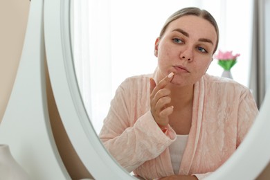 Photo of Woman with acne problem looking in mirror at home