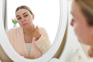 Photo of Woman with acne problem looking in mirror at home