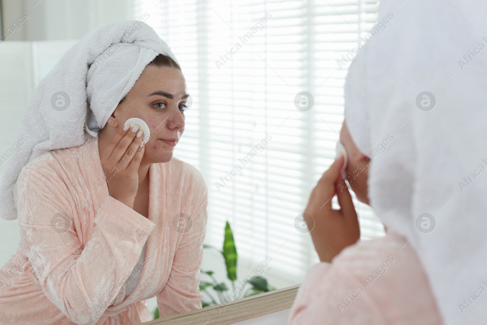 Woman with acne problem cleaning her face near mirror indoors Photo of Woman with acne problem cleaning her face near mirror indoors