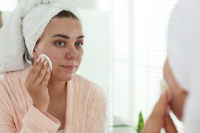Photo of Woman with acne problem cleaning her face near mirror indoors