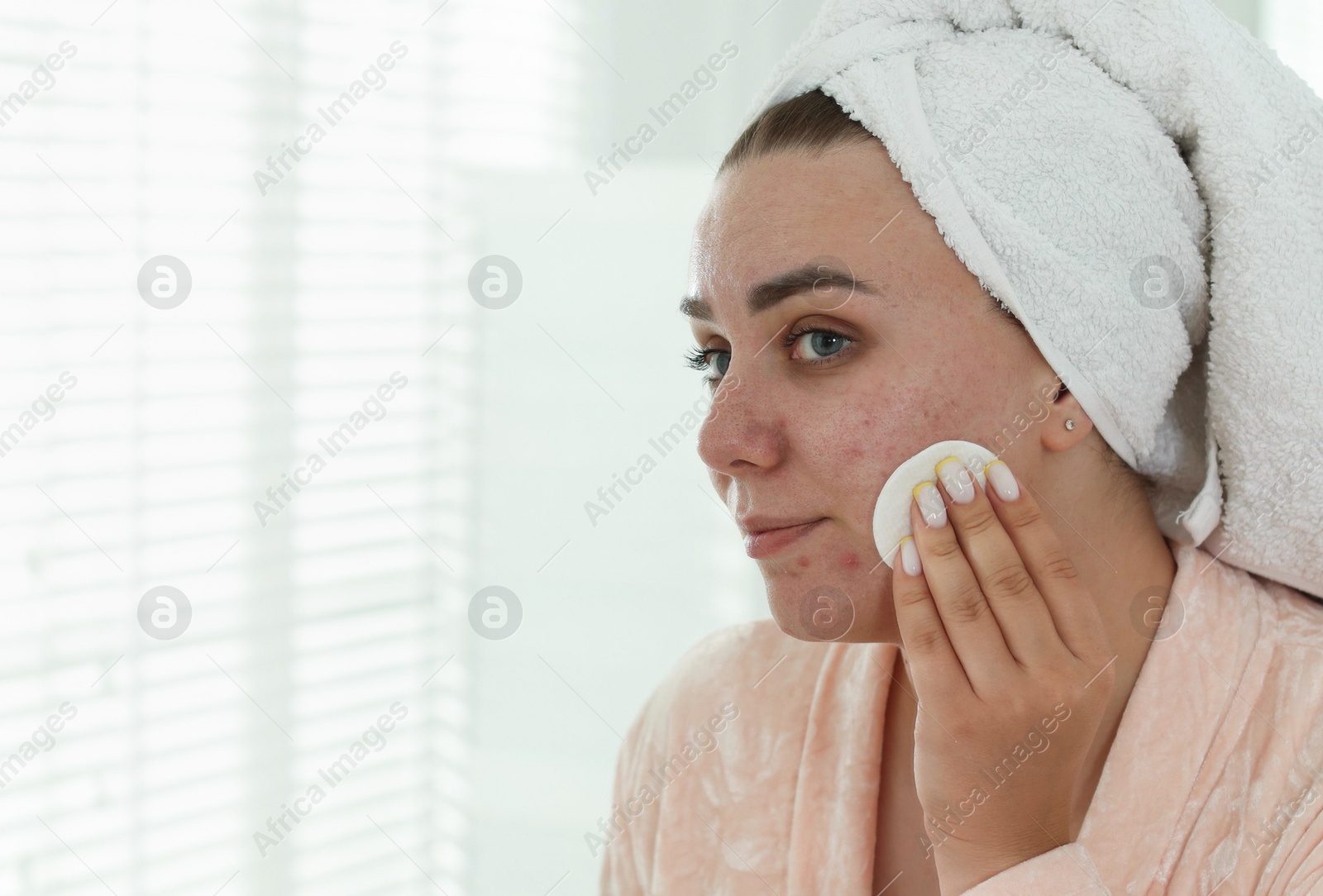 Photo of Woman with acne problem cleaning her face near mirror indoors, space for text