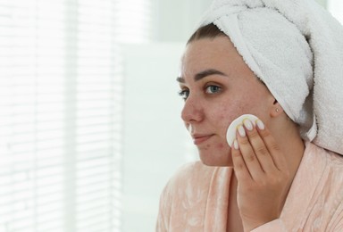 Photo of Woman with acne problem cleaning her face near mirror indoors, space for text