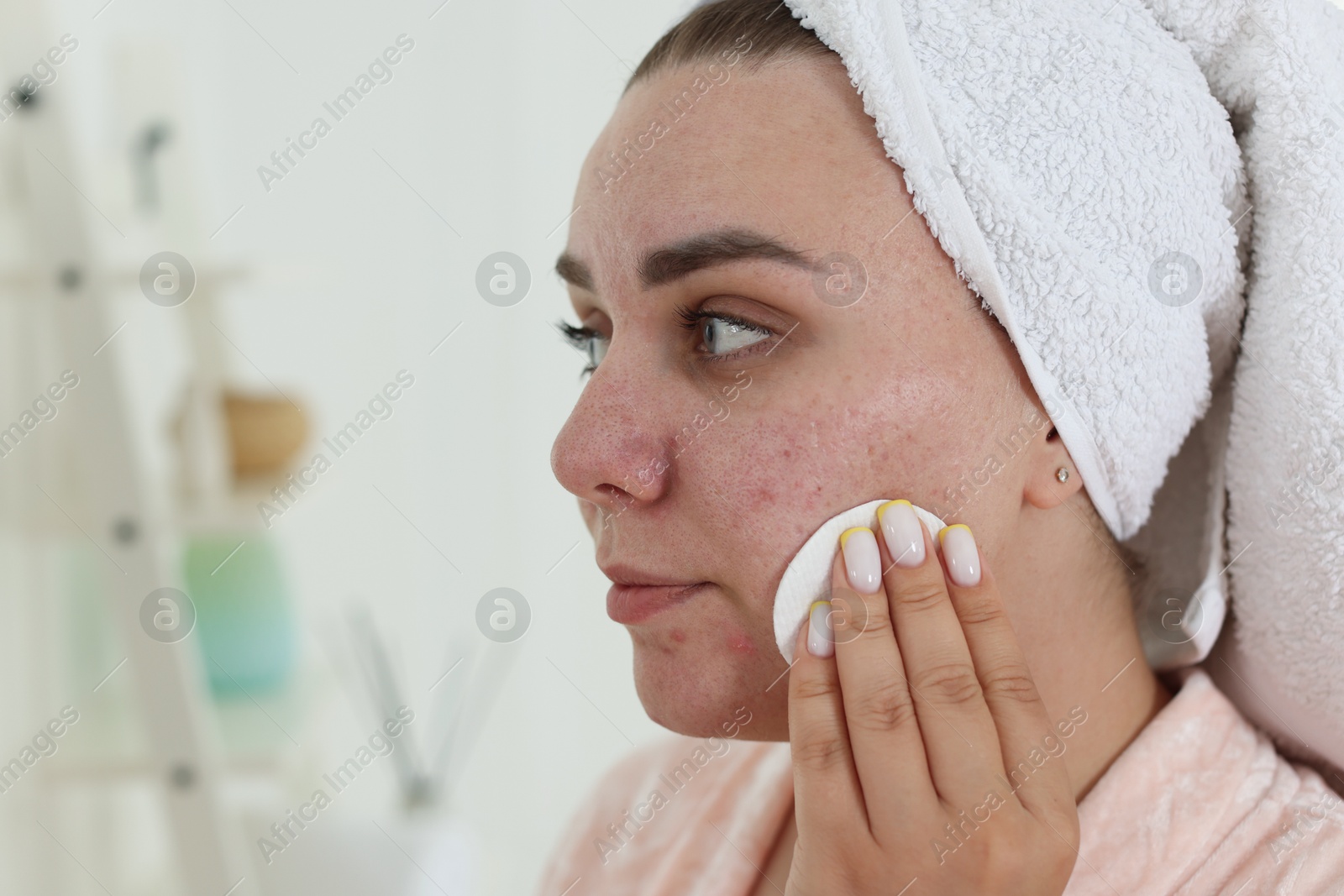 Woman with acne problem cleaning her face near mirror indoors, space for text Photo of Woman with acne problem cleaning her face near mirror indoors, space for text
