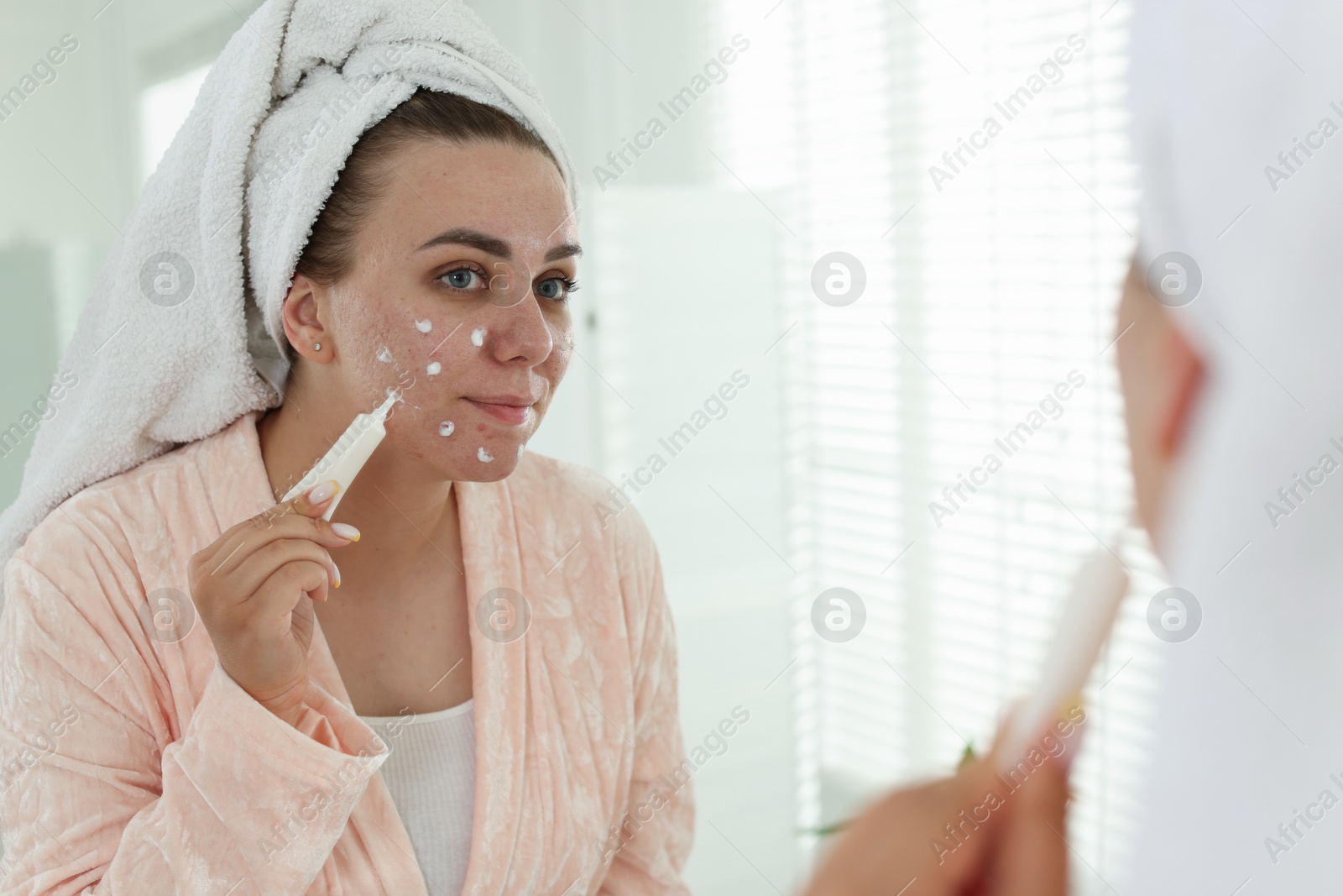 Woman applying cream onto face near mirror indoors. Acne treatment Photo of Woman applying cream onto face near mirror indoors. Acne treatment