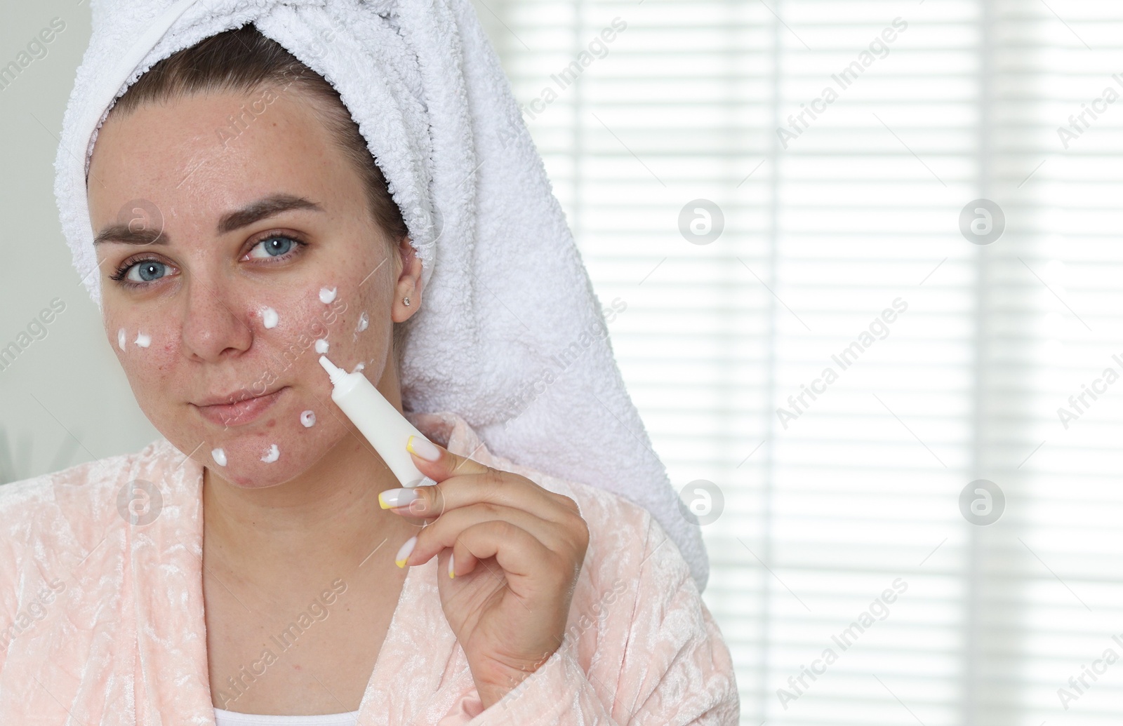 Woman applying cream onto face in bathroom, space for text. Acne treatment Photo of Woman applying cream onto face in bathroom, space for text. Acne treatment