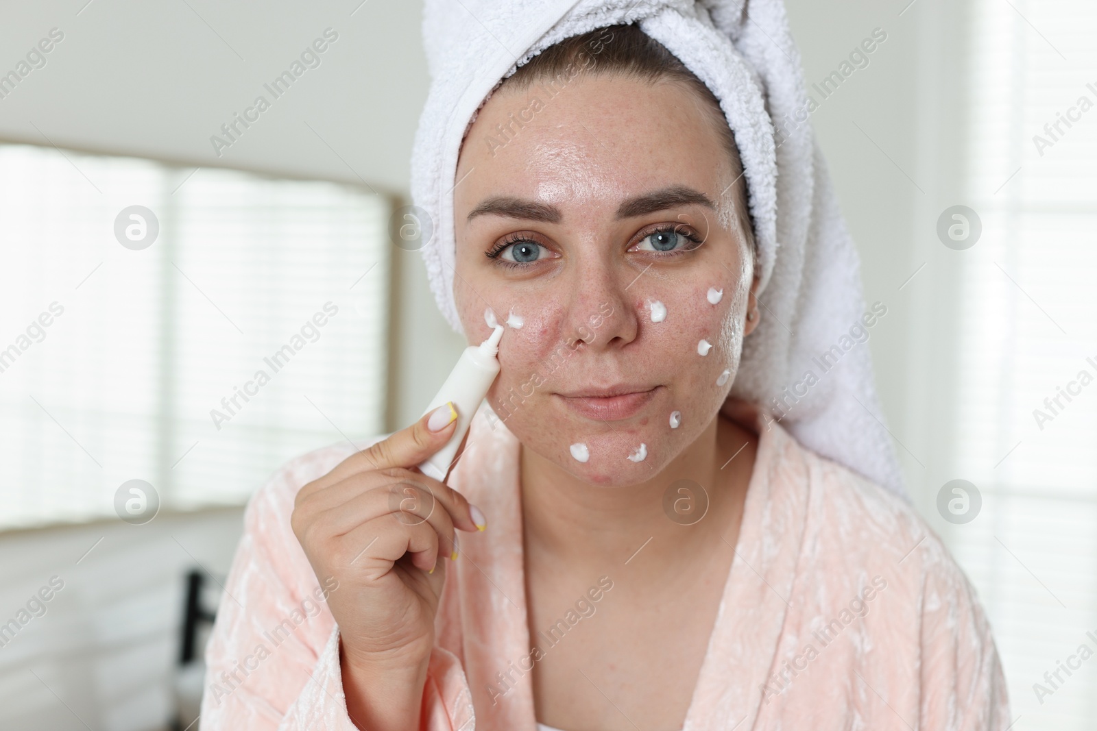 Photo of Woman applying cream onto face in bathroom. Acne treatment