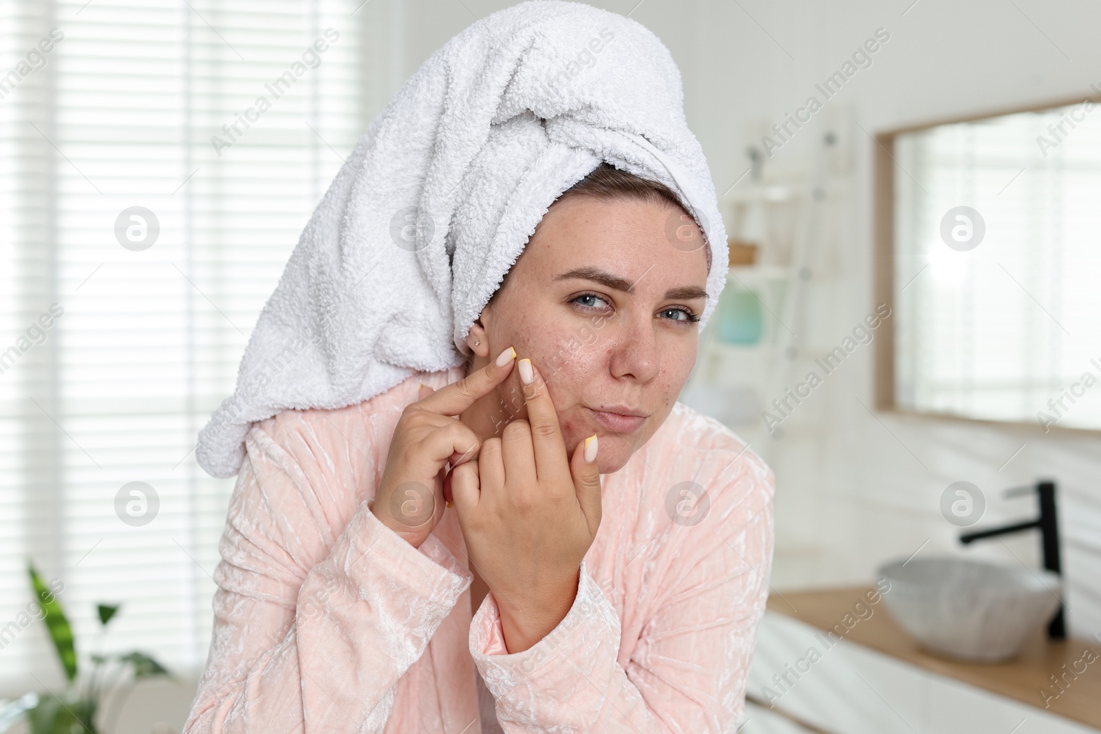 Woman popping pimple in bathroom. Acne problem Photo of Woman popping pimple in bathroom. Acne problem