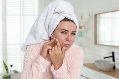 Photo of Woman popping pimple in bathroom. Acne problem