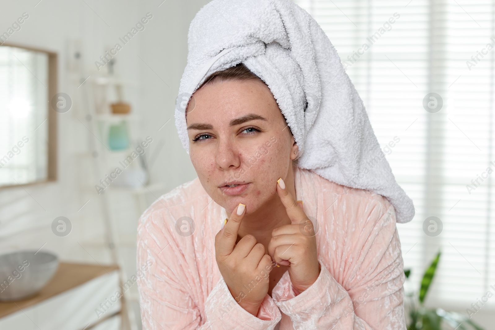 Woman popping pimple in bathroom. Acne problem Photo of Woman popping pimple in bathroom. Acne problem