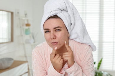 Photo of Woman popping pimple in bathroom. Acne problem