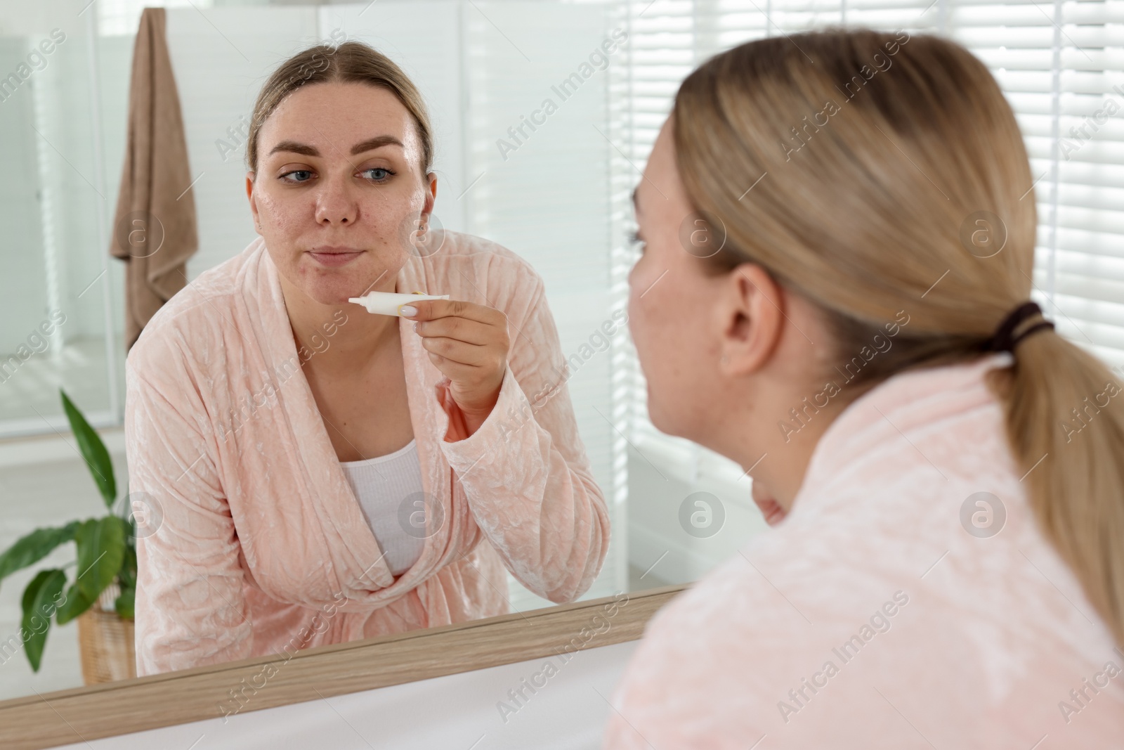 Woman applying cream onto face near mirror indoors. Acne treatment Photo of Woman applying cream onto face near mirror indoors. Acne treatment