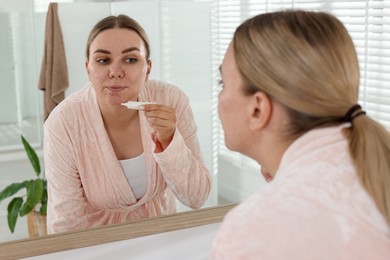 Photo of Woman applying cream onto face near mirror indoors. Acne treatment