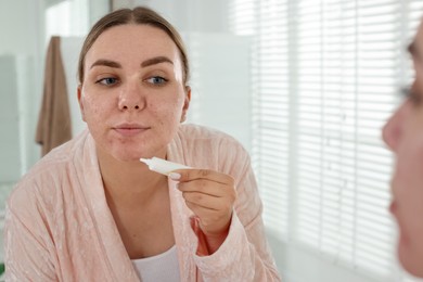 Photo of Woman applying cream onto face near mirror indoors. Acne treatment