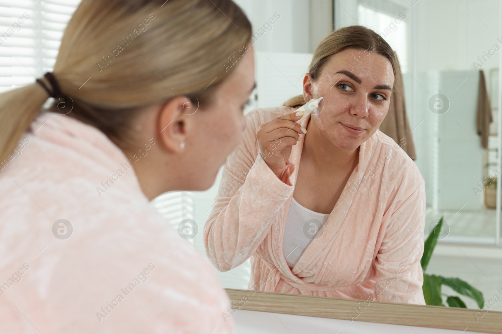 Woman applying cream onto face near mirror indoors. Acne treatment Photo of Woman applying cream onto face near mirror indoors. Acne treatment